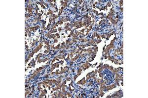 IHC analysis of SDF2L1 using anti-SDF2L1 antibody (ABIN7601111).