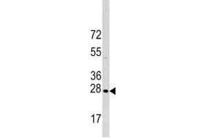 Western blot analysis of HSP27 antibody and HeLa lysate.