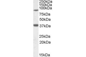 Western Blotting (WB) image for anti-Ceramide Synthase 1 (CERS1) (Internal Region) antibody (ABIN2466789) (LASS1 抗体  (Internal Region))
