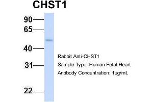 Host: Rabbit Target Name: CHST1 Sample Type: Human Fetal Heart Antibody Dilution: 1. (CHST1 抗体  (Middle Region))