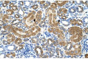 Human kidney (ATIC 抗体  (Middle Region))