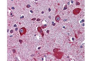 Anti-LRP8 antibody IHC of human brain, cortex. (LRP8 抗体  (AA 395-444))
