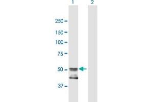 Western Blot analysis of GCNT4 expression in transfected 293T cell line by GCNT4 MaxPab polyclonal antibody. (GCNT4 抗体  (AA 1-453))