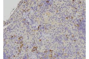 ABIN6278916 at 1/100 staining Human lymph node tissue by IHC-P. (Keratin 31 抗体)