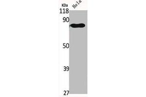 Western Blot analysis of HELA cells using GRK 2 Polyclonal Antibody (GRK2 抗体  (C-Term))