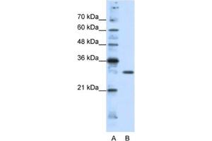 Western Blotting (WB) image for anti-Goosecoid Homeobox 2 (GSC2) antibody (ABIN2461751)