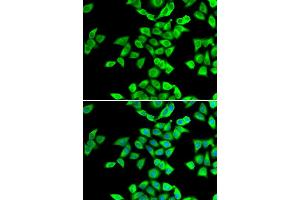 Immunofluorescence analysis of U20S cell using NMT2 antibody. (NMT2 抗体)