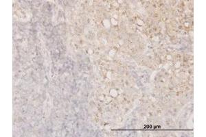 Image no. 3 for anti-Cofilin 1 (CFL1) (AA 1-167) antibody (ABIN598606) (Cofilin 抗体  (AA 1-167))