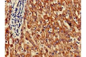 Immunohistochemistry of paraffin-embedded human liver tissue using ABIN7154260 at dilution of 1:100 (GRHPR 抗体  (AA 1-328))