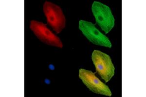 ABIN7096223 and ABIN7100285 staining  cells by IF/ICC.