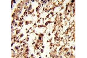 IHC analysis of FFPE human testis tissue stained with TBP antibody (TBP 抗体  (AA 301-330))