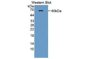 Western Blotting (WB) image for anti-Ectonucleotide Pyrophosphatase/phosphodiesterase 1 (ENPP1) (AA 568-793) antibody (ABIN1858719) (ENPP1 抗体  (AA 568-793))