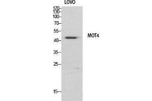 Western Blot (WB) analysis of specific cells using MCT4 Polyclonal Antibody. (SLC16A3 抗体  (Internal Region))