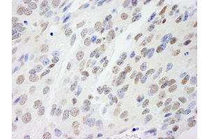 Immunohistochemistry (IHC) image for anti-Non-POU Domain Containing, Octamer-Binding (NONO) (AA 350-400) antibody (ABIN7448694)
