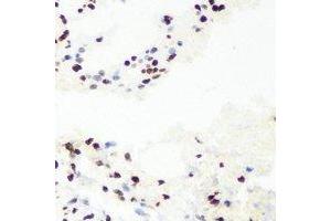 Immunohistochemical analysis of RNGTT staining in mouse lung formalin fixed paraffin embedded tissue section. (RNGTT 抗体)