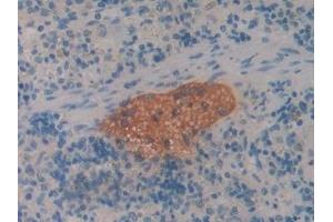 Detection of CBG in Rat Spleen Tissue using Polyclonal Antibody to Corticosteroid Binding Globulin (CBG) (SERPINA6 抗体  (AA 267-390))