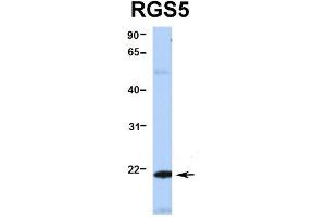 Hum. (RGS5 抗体  (Middle Region))