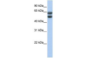 WB Suggested Anti-ZNF331 Antibody Titration:  0. (ZNF331 抗体  (N-Term))