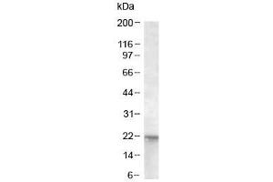 Western blot of A431 lysate with NRAS antibody at 0. (GTPase NRas 抗体)