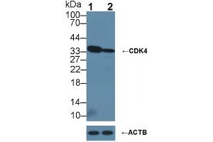 Knockout Varification: ;Lane 1: Wild-type Hela cell lysate; ;Lane 2: CDK4 knockout Hela cell lysate; ;Predicted MW: 33kDa ;Observed MW: 33kDa;Primary Ab: 1µg/ml Rabbit Anti-Human CDK4 Ab;Second Ab: 0. (CDK4 抗体  (AA 6-295))