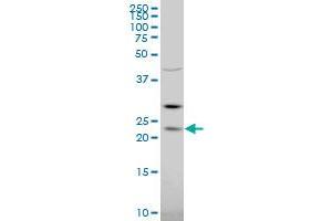 RGS5 polyclonal antibody (A01), Lot # 060608JCS1 Western Blot analysis of RGS5 expression in K-562 . (RGS5 抗体  (AA 94-181))