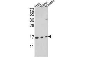 Western blot analysis of PPIA Antibody (PPIA 抗体  (N-Term))