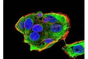 Immunofluorescence analysis of HeLa cells using DDX20 mouse mAb (green).