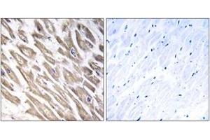 Immunohistochemistry analysis of paraffin-embedded human heart tissue, using F13B Antibody. (F13B 抗体  (AA 61-110))