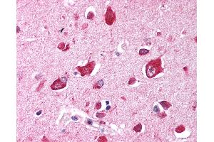 Anti-TRIM35 antibody IHC of human brain, cortex. (TRIM35 抗体  (AA 145-194))