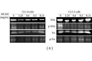 Effects of MCME on the invasion of CL1-0 and CL1-5 cells.