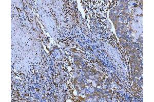 IHC analysis of Hsp47/SERPINH1 using anti-Hsp47/SERPINH1 antibody (ABIN3043331). (SERPINH1 抗体  (AA 247-418))