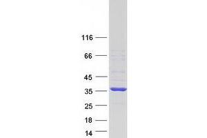 Western Blotting (WB) image for Menage A Trois Homolog 1, Cyclin H Assembly Factor (Xenopus Laevis) (MNAT1) protein (Myc-DYKDDDDK Tag) (ABIN2726185)