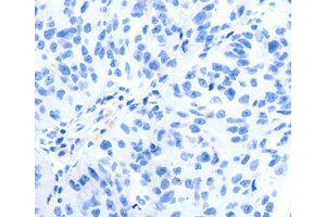 Immunohistochemistry (IHC) image for anti-Glutamate Receptor, Metabotropic 8 (GRM8) antibody (ABIN1872903) (GRM8 抗体)