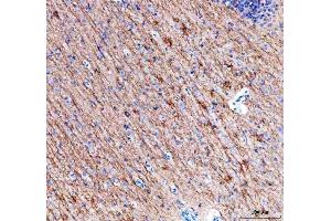 IHC analysis of Alpha Internexin using anti-Alpha Internexin antibody (ABIN4886634).