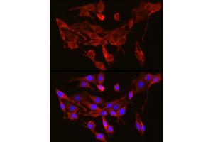Immunofluorescence (IF) image for anti-Sec61 alpha 1 Subunit (SEC61A1) (AA 310-420) antibody (ABIN6147493)
