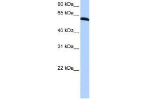 TRIP6 antibody used at 0. (TRIP6 抗体  (N-Term))