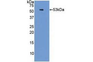 Detection of Recombinant PSMC3, Human using Polyclonal Antibody to Proteasome 26S Subunit, ATPase 3 (PSMC3) (PSMC3 抗体  (AA 2-439))
