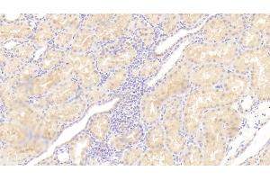 Detection of IL23a in Human Kidney Tissue using Polyclonal Antibody to Interleukin 23 Subunit Alpha (IL23a) (IL23A 抗体  (AA 20-189))