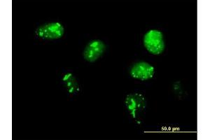 Immunofluorescence of purified MaxPab antibody to TCF19 on HeLa cell. (TCF19 抗体  (AA 1-345))