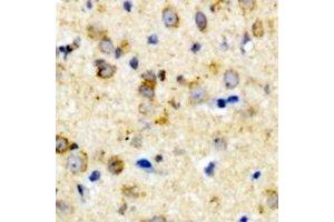 Immunohistochemical analysis of CALHM1 staining in rat brain formalin fixed paraffin embedded tissue section. (CALHM1 抗体)