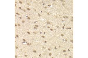 Immunohistochemistry of paraffin-embedded mouse brain using JMJD6 Antibody (ABIN5973452) at dilution of 1/200 (40x lens). (JMJD6 抗体)