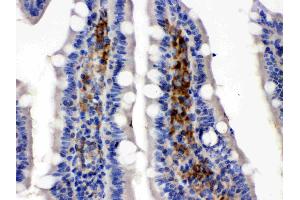 Immunohistochemistry (IHC) image for anti-Solute Carrier Family 2 (Facilitated Glucose/fructose Transporter), Member 5 (SLC2A5) (AA 223-259), (Middle Region) antibody (ABIN4886727)