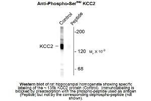 Western blot of Anti-Potassium Chloride Cotransporter (KCC2) pS940 (Rabbit) Antibody - 612-401-E15 Western Blot of Rabbit anti-Potassium Chloride Cotransporter (KCC2) pS940 antibody.