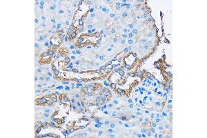Immunohistochemistry of paraffin-embedded Mouse kidney using C Rabbit pAb (ABIN3022800, ABIN3022801, ABIN3022802 and ABIN6219234) at dilution of 1:50 (40x lens). (CAPZA2 抗体  (AA 1-286))