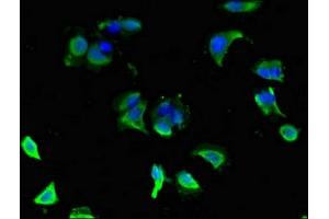 Immunofluorescent analysis of MCF-7 cells using ABIN7154186 at dilution of 1:100 and Alexa Fluor 488-congugated AffiniPure Goat Anti-Rabbit IgG(H+L) (GLRA1 抗体  (AA 23-113))