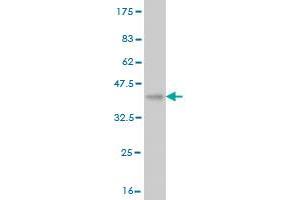 Western Blot detection against Immunogen (36. (VPS18 抗体  (AA 3-100))