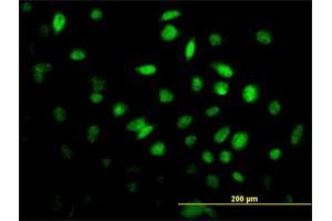 Immunofluorescence of monoclonal antibody to FOXF2 on HeLa cell. (FOXF2 抗体  (AA 346-443))