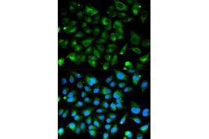 Immunofluorescence analysis of HeLa cell using PRKAR1A antibody. (PRKAR1A 抗体  (AA 1-250))