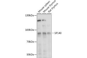 Western blot analysis of extracts of various cell lines, using SP140 antibody (ABIN7270507) at 1:1000 dilution. (SP140 抗体  (AA 1-180))