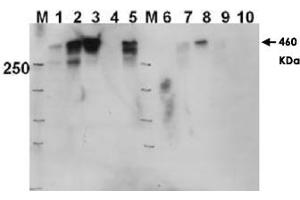 Western blot using PRKDC (phospho T2609) polyclonal antibody  shows detection of a 460 KDa band corresponding to human PRKDC in various preparations. (PRKDC 抗体  (pThr2609))